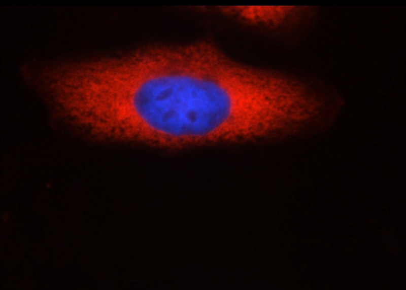 Immunofluorescent analysis of HepG2 cells using Catalog No:107598(SND1 Antibody) at dilution of 1:50 and and Rhodamine-labeled goat anti-mouse IgG (red).