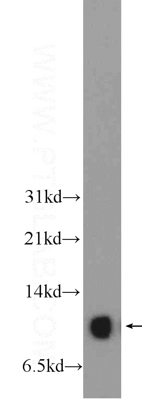human placenta tissue were subjected to SDS PAGE followed by western blot with Catalog No:115463(SNRPE Antibody) at dilution of 1:600