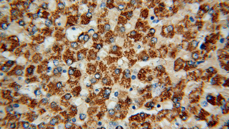 Immunohistochemical of paraffin-embedded human liver using Catalog No:107703(ACSS3 antibody) at dilution of 1:100 (under 40x lens)