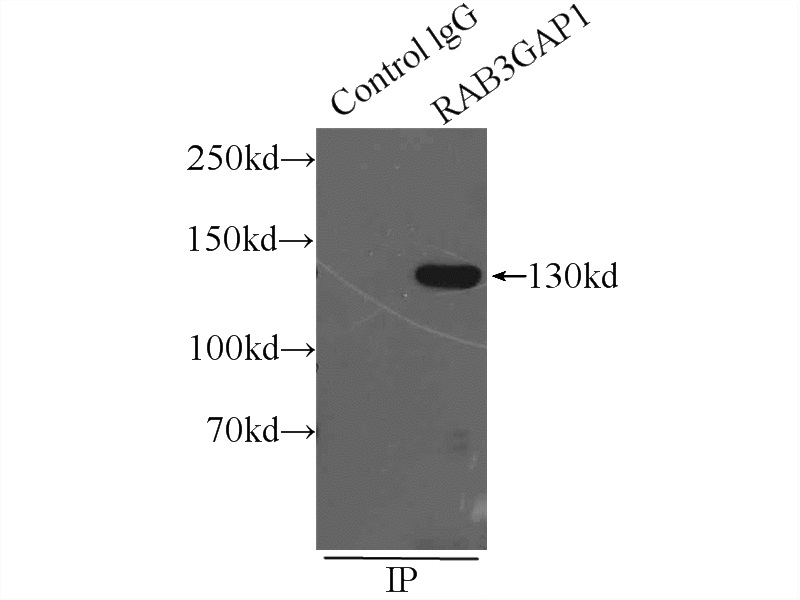 IP Result of anti-RAB3GAP1 (IP:Catalog No:114445, 5ug; Detection:Catalog No:114445 1:500) with mouse kidney tissue lysate 6000ug.