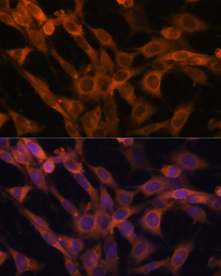 Immunofluorescence - RAB21 Polyclonal Antibody 