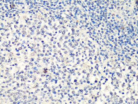 Immunohistochemistry - MTA2 Polyclonal Antibody 