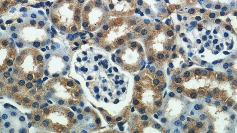 Immunohistochemical of paraffin-embedded mouse kidney using Catalog No:115124(SEPX1 antibody) at dilution of 1:50 (under 40x lens)
