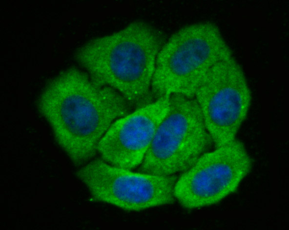 Fig3:; ICC staining of Galectin 8 in HepG2 cells (green). Formalin fixed cells were permeabilized with 0.1% Triton X-100 in TBS for 10 minutes at room temperature and blocked with 1% Blocker BSA for 15 minutes at room temperature. Cells were probed with the primary antibody ( 1/50) for 1 hour at room temperature, washed with PBS. Alexa Fluor®488 Goat anti-Rabbit IgG was used as the secondary antibody at 1/1,000 dilution. The nuclear counter stain is DAPI (blue).