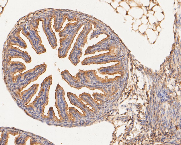 Fig6:; Immunohistochemical analysis of paraffin-embedded mouse fallopian tube tissue using anti-GM648 antibody. The section was pre-treated using heat mediated antigen retrieval with Tris-EDTA buffer (pH 8.0-8.4) for 20 minutes.The tissues were blocked in 5% BSA for 30 minutes at room temperature, washed with ddH; 2; O and PBS, and then probed with the primary antibody ( 1/100) for 30 minutes at room temperature. The detection was performed using an HRP conjugated compact polymer system. DAB was used as the chromogen. Tissues were counterstained with hematoxylin and mounted with DPX.