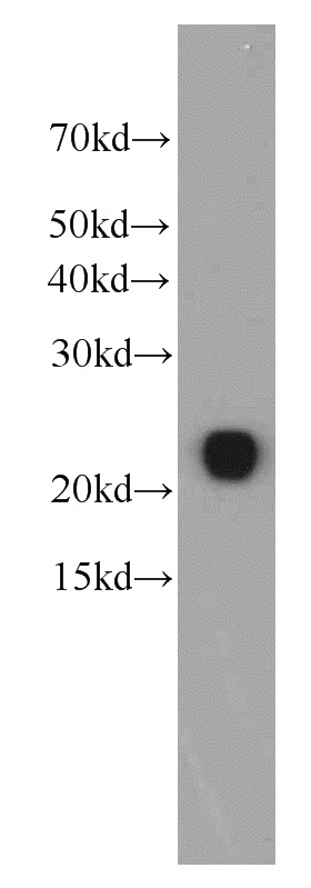 human blood tissue were subjected to SDS PAGE followed by western blot with Catalog No:107502(RBP4 antibody) at dilution of 1:4000