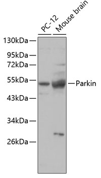 Western blot - Parkin Polyclonal Antibody 