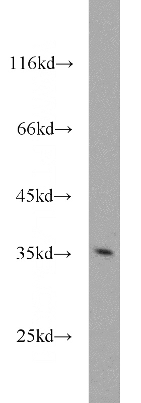HepG2 cells were subjected to SDS PAGE followed by western blot with Catalog No:113833(PIR antibody) at dilution of 1:500