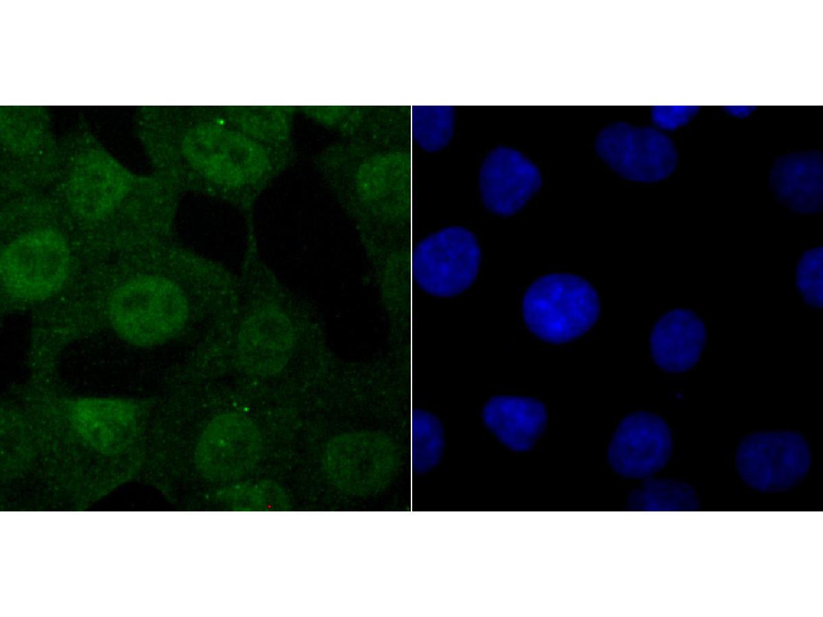 Fig2:; ICC staining of USP11 in A549 cells (green). Formalin fixed cells were permeabilized with 0.1% Triton X-100 in TBS for 10 minutes at room temperature and blocked with 10% negative goat serum for 15 minutes at room temperature. Cells were probed with the primary antibody ( 1/50) for 1 hour at room temperature, washed with PBS. Alexa Fluor®488 conjugate-Goat anti-Rabbit IgG was used as the secondary antibody at 1/1,000 dilution. The nuclear counter stain is DAPI (blue).
