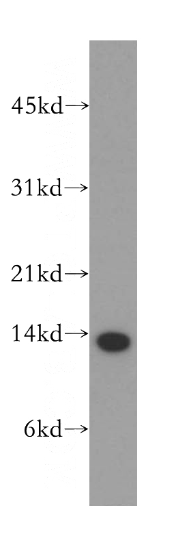 human liver tissue were subjected to SDS PAGE followed by western blot with Catalog No:111467(UK114; HRSP12 antibody) at dilution of 1:300
