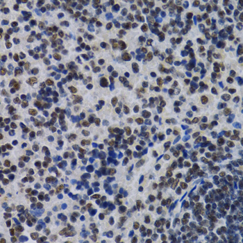 Immunohistochemistry - ID3 Polyclonal Antibody 