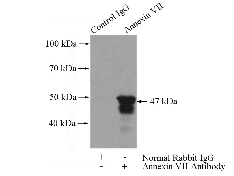 IP Result of anti-ANXA7 (IP:Catalog No:108098, 4ug; Detection:Catalog No:108098 1:800) with mouse heart tissue lysate 3200ug.