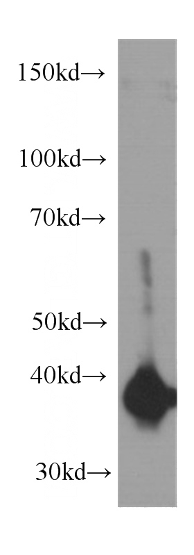 K-562 cells were subjected to SDS PAGE followed by western blot with Catalog No:107055(ANXA2 antibody) at dilution of 1:1000
