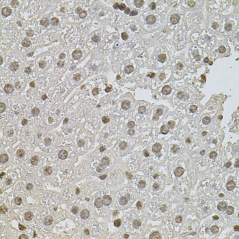 Immunohistochemistry - ZNF408 Polyclonal Antibody 
