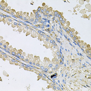 Immunohistochemistry - PPIC Polyclonal Antibody 
