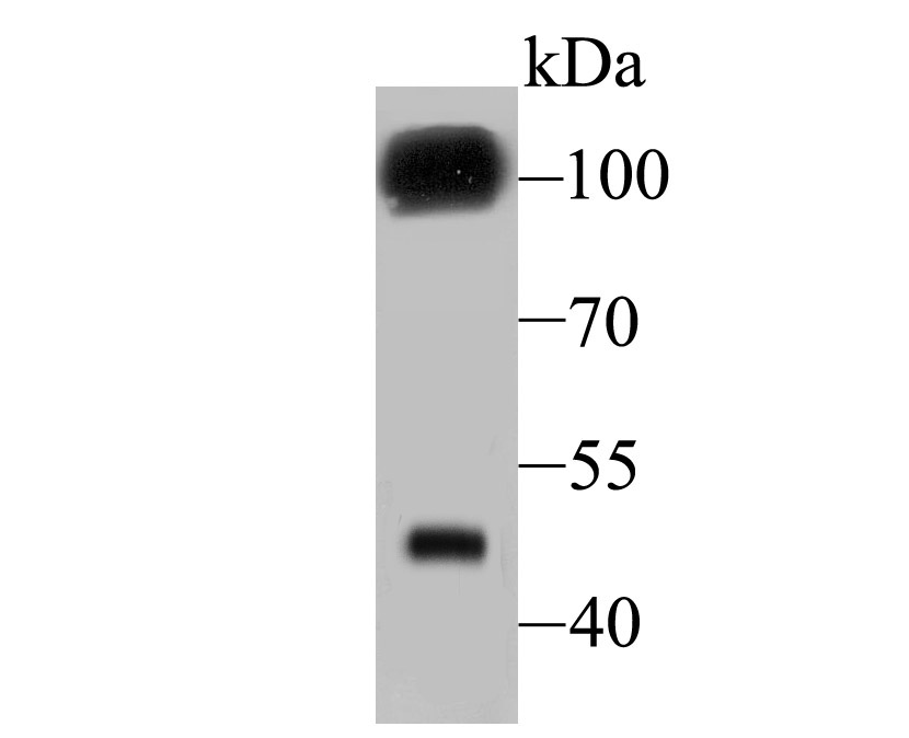Fig1: Western blot analysis of GABA B Receptor 2 on mouse cerebellum tissue lysate using anti- GABA B Receptor 2 antibody at 1/500 dilution.