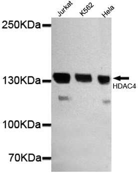 Western blot detection of HDAC4 in Jurkat,Hela and K562 cell lysates using HDAC4 mouse mAb (1:1000 diluted).Predicted band size: 140KDa.Observed band size: 140KDa.