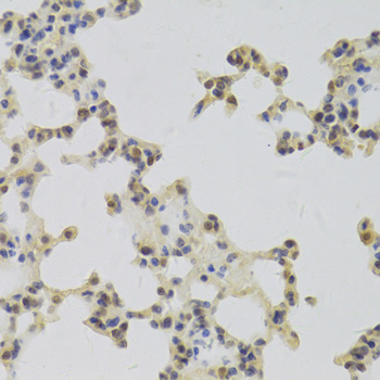Immunohistochemistry - HDGF Polyclonal Antibody 