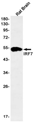 Western blot detection of IRF7 in Rat Brain lysates using IRF7 Rabbit mAb(1:1000 diluted).Predicted band size:54kDa.Observed band size:54kDa.
