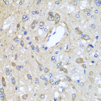 Immunohistochemistry - CXCR4 Polyclonal Antibody 