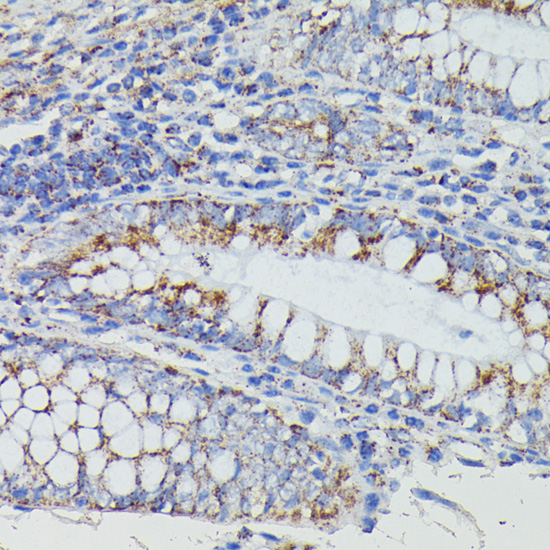 Immunohistochemistry - NDUFAB1 Polyclonal Antibody 