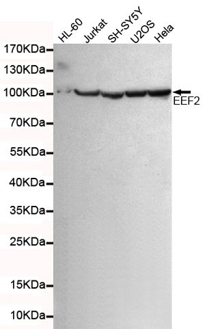 Western blot detection of eEF2 in HL-60,Jurkat,SHSY-5Y,U20S and Hela cell lysates using eEF2 mouse mAb (1:5000 diluted).Predicted band size:95KDa.Observed band size: 95KDa.Exposure time:15s.