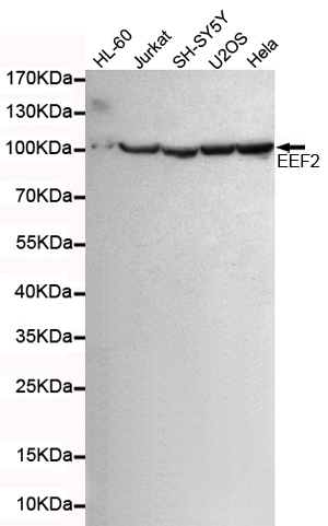Western blot detection of eEF2 in HL-60,Jurkat,SHSY-5Y,U20S and Hela cell lysates using eEF2 mouse mAb (1:5000 diluted).Predicted band size:95KDa.Observed band size: 95KDa.Exposure time:15s.