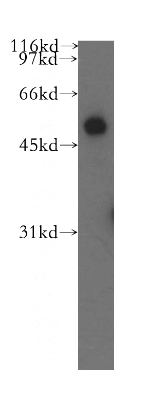 mouse lung tissue were subjected to SDS PAGE followed by western blot with Catalog No:108900(CBLC antibody) at dilution of 1:500