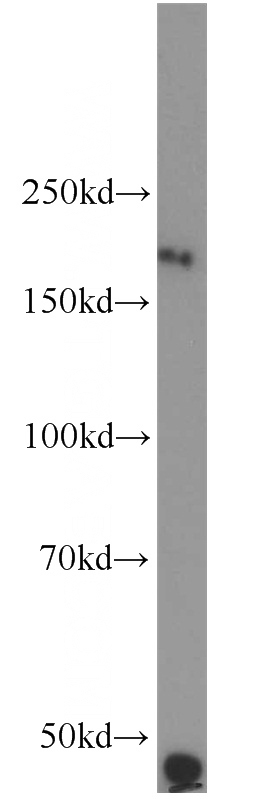 mouse brain tissue were subjected to SDS PAGE followed by western blot with Catalog No:114865(RTN4 antibody) at dilution of 1:300