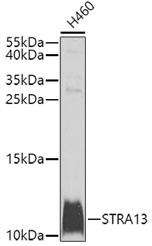 Western blot - STRA13 Polyclonal Antibody 