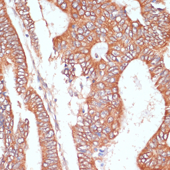 Immunohistochemistry - PTPRN2 Polyclonal Antibody 
