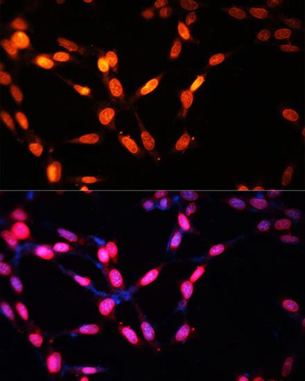 Immunofluorescence - MYOG Polyclonal Antibody 