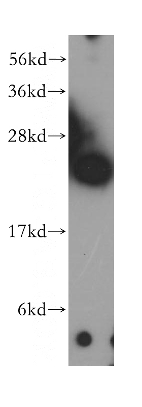 mouse heart tissue were subjected to SDS PAGE followed by western blot with Catalog No:113087(NDUFV2 antibody) at dilution of 1:400