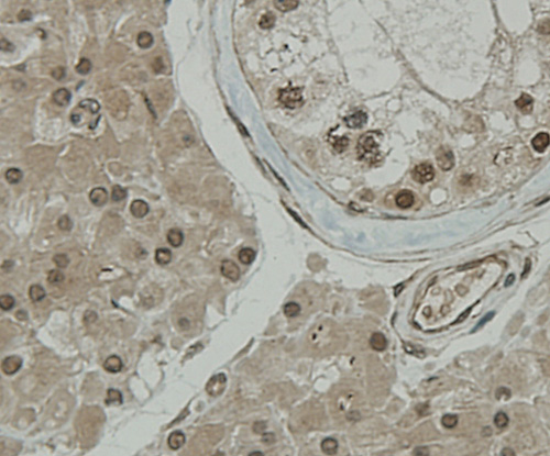 Fig5: Immunohistochemical analysis of paraffin-embedded human tonsil tissue using anti-CCDC51 antibody. Counter stained with hematoxylin.