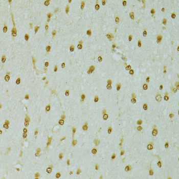 Immunohistochemistry - RCC1 Polyclonal Antibody 