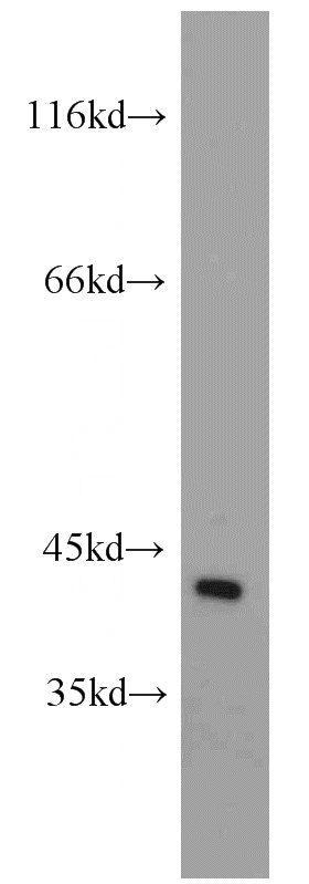 MCF7 cells were subjected to SDS PAGE followed by western blot with Catalog No:110842(GALK1 antibody) at dilution of 1:1200