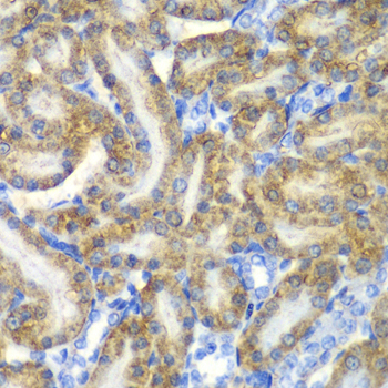 Immunohistochemistry - FAH Polyclonal Antibody 
