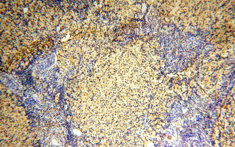 Immunohistochemical of paraffin-embedded human ovary using Catalog No:108109(ANTXR2 antibody) at dilution of 1:100 (under 10x lens)