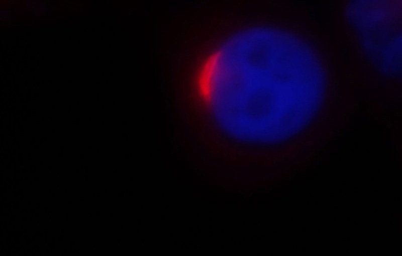 Immunofluorescent analysis of Hela cells, using GOLM1 antibody Catalog No:111054 at 1:25 dilution and Rhodamine-labeled goat anti-rabbit IgG (red).