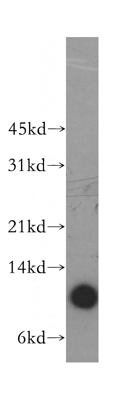 HeLa cells were subjected to SDS PAGE followed by western blot with Catalog No:117131(B2M antibody) at dilution of 1:1000