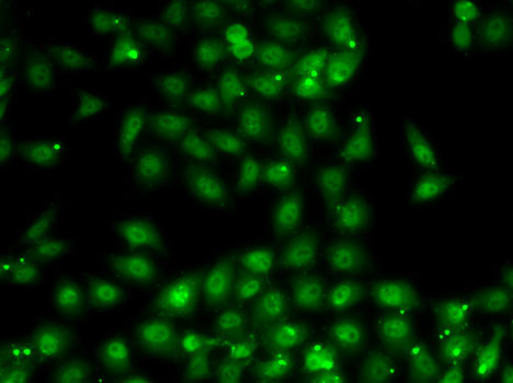 Immunofluorescence - MBNL1 Polyclonal Antibody 