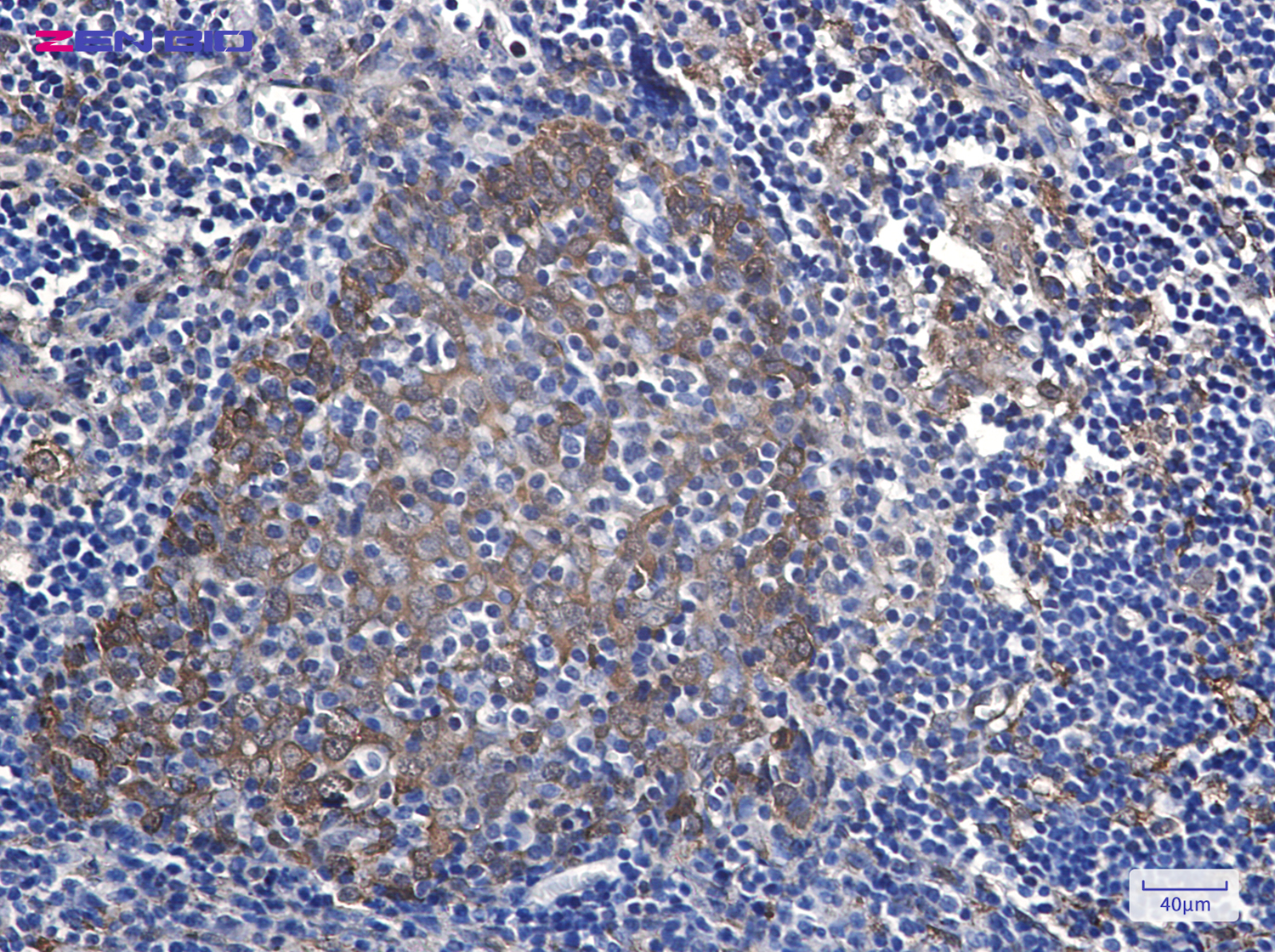 Immunohistochemistry of Hsp27 in paraffin-embedded Human tonsil using Hsp27 Rabbit pAb at dilution 1/20