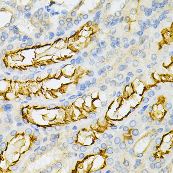 Immunohistochemistry - PPP2R4 Polyclonal Antibody 