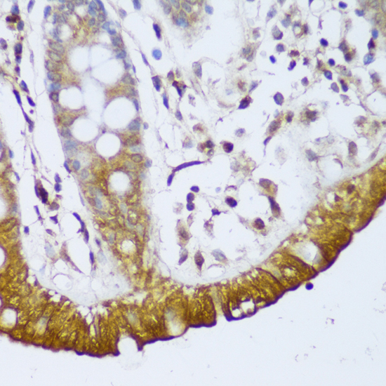 Immunohistochemistry - GCC2 Polyclonal Antibody 