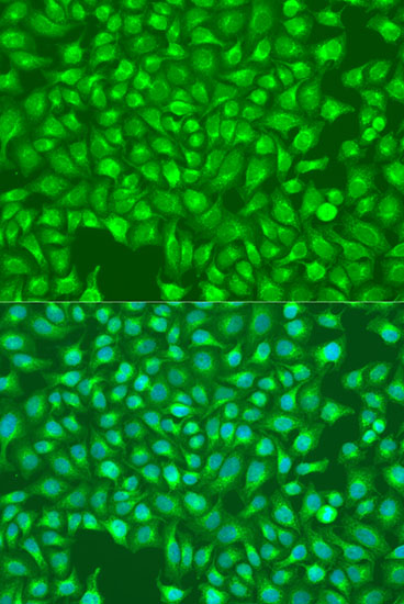 Immunofluorescence - ITPR1 Polyclonal Antibody 