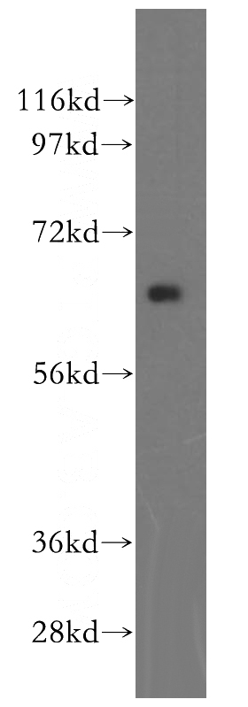 Jurkat cells were subjected to SDS PAGE followed by western blot with Catalog No:111303(HEXB antibody) at dilution of 1:200