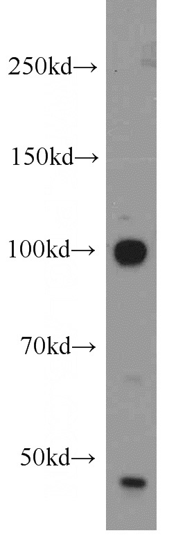 HeLa cells were subjected to SDS PAGE followed by western blot with Catalog No:116593(USP16 antibody) at dilution of 1:1000