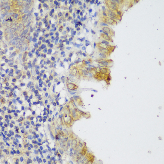 Immunohistochemistry - GCC2 Polyclonal Antibody 