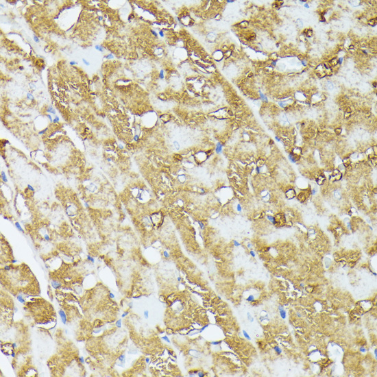 Immunohistochemistry - COX15 Polyclonal Antibody 
