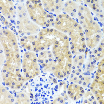 Immunohistochemistry - INADL Polyclonal Antibody 